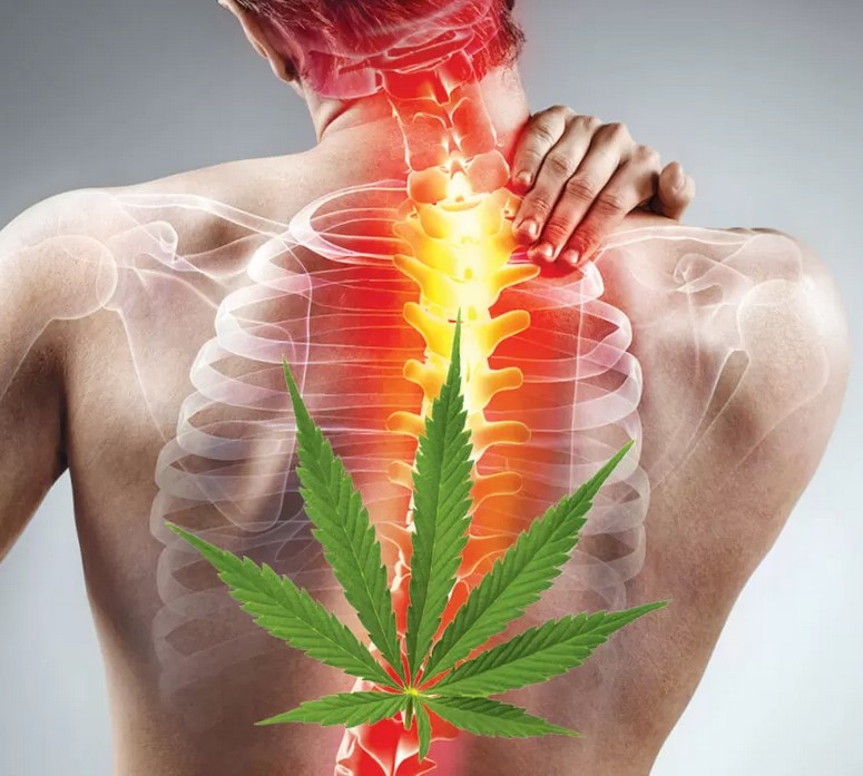 medical cannabis for back pain relief 2 - Medical Cannabis for Back Pain Relief